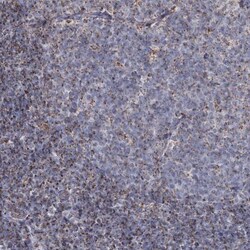 MRPL44 Antibody, Novus Biologicals:Antibodies:Primary Antibodies
